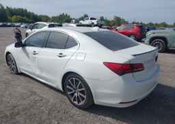 2017 ACURA TLX TECH