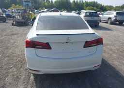 2017 ACURA TLX TECH