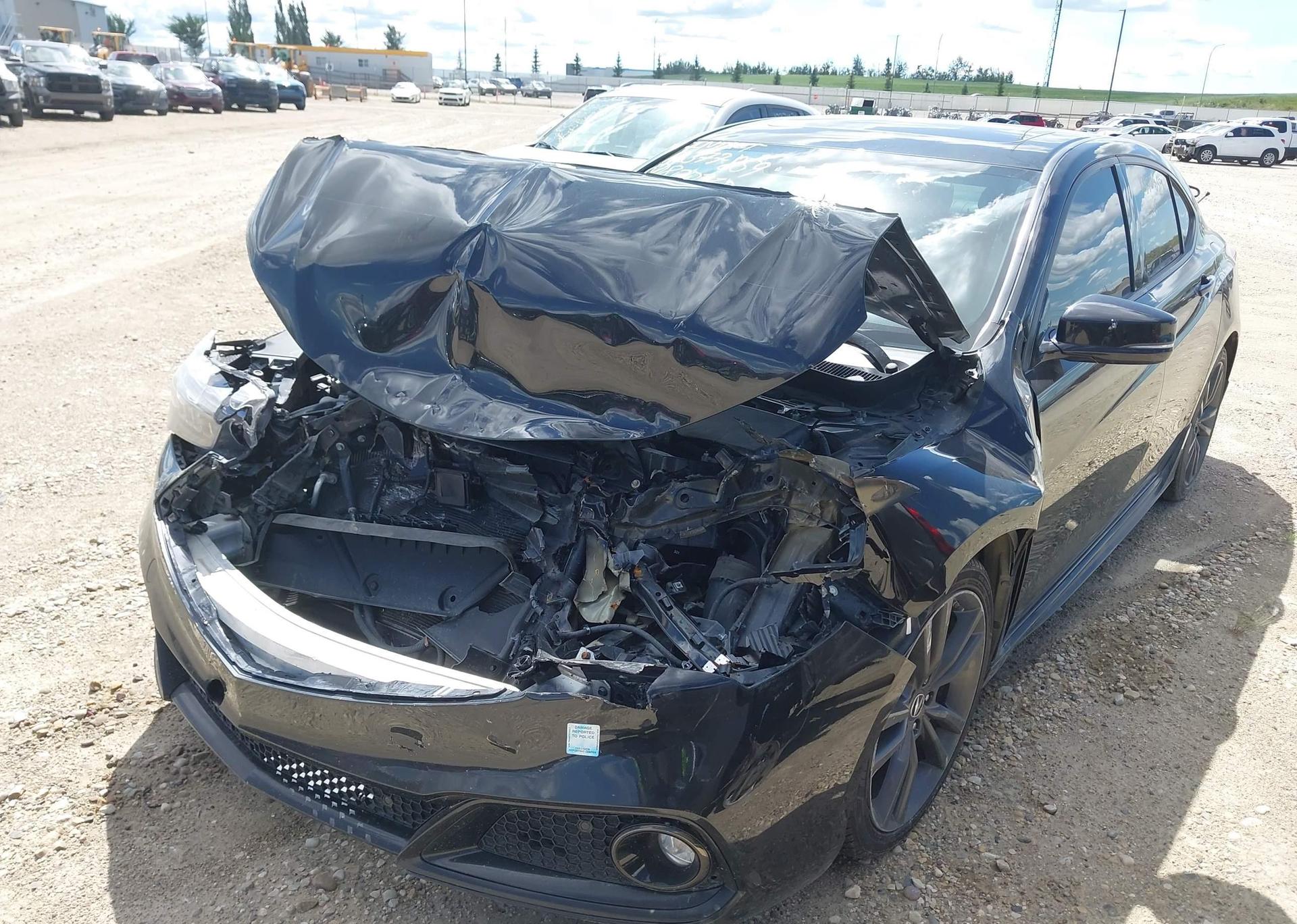 2018 ACURA TLX TECH