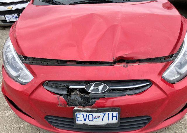 2017 HYUNDAI ACCENT SE