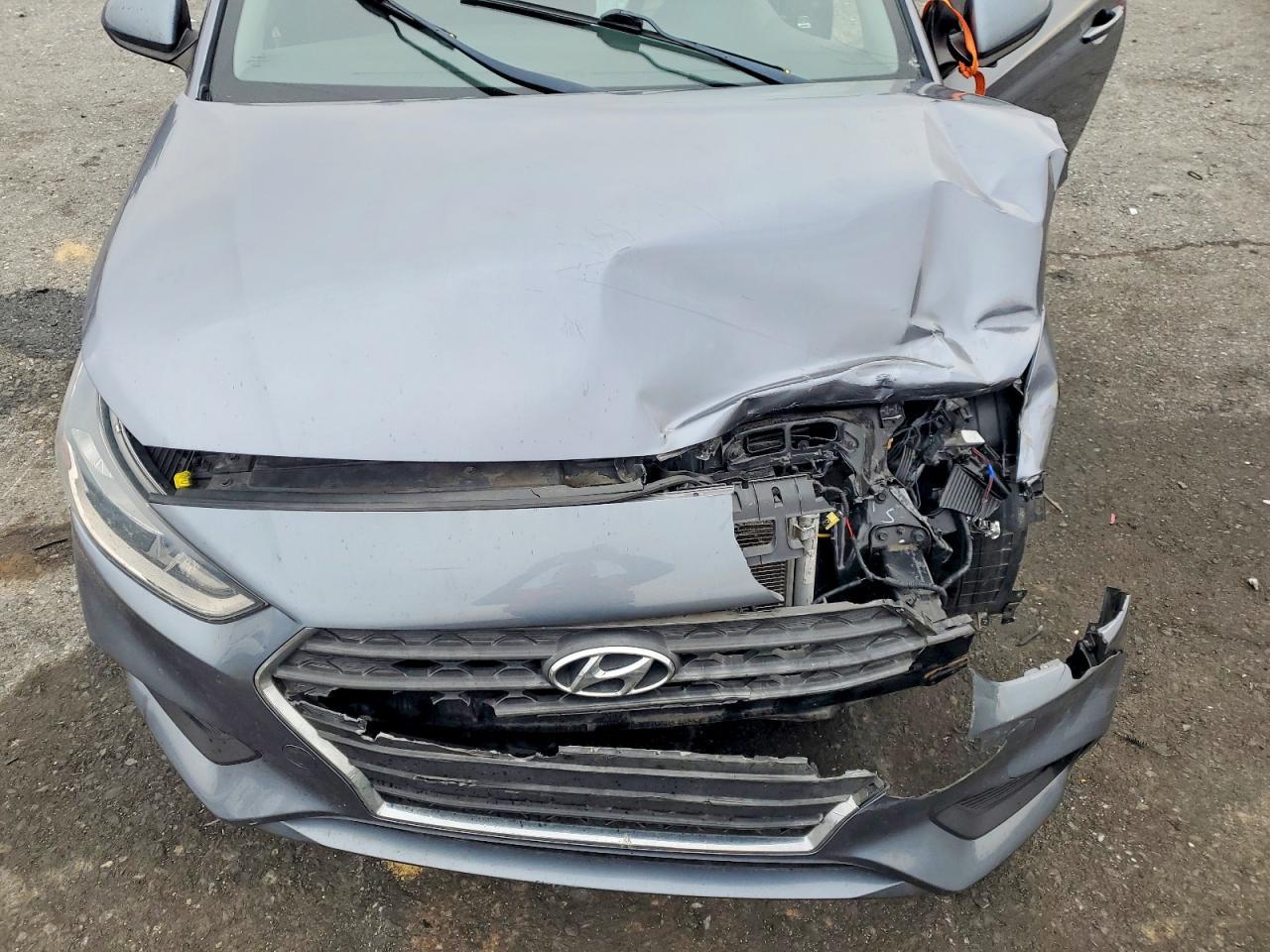 2018 HYUNDAI ACCENT