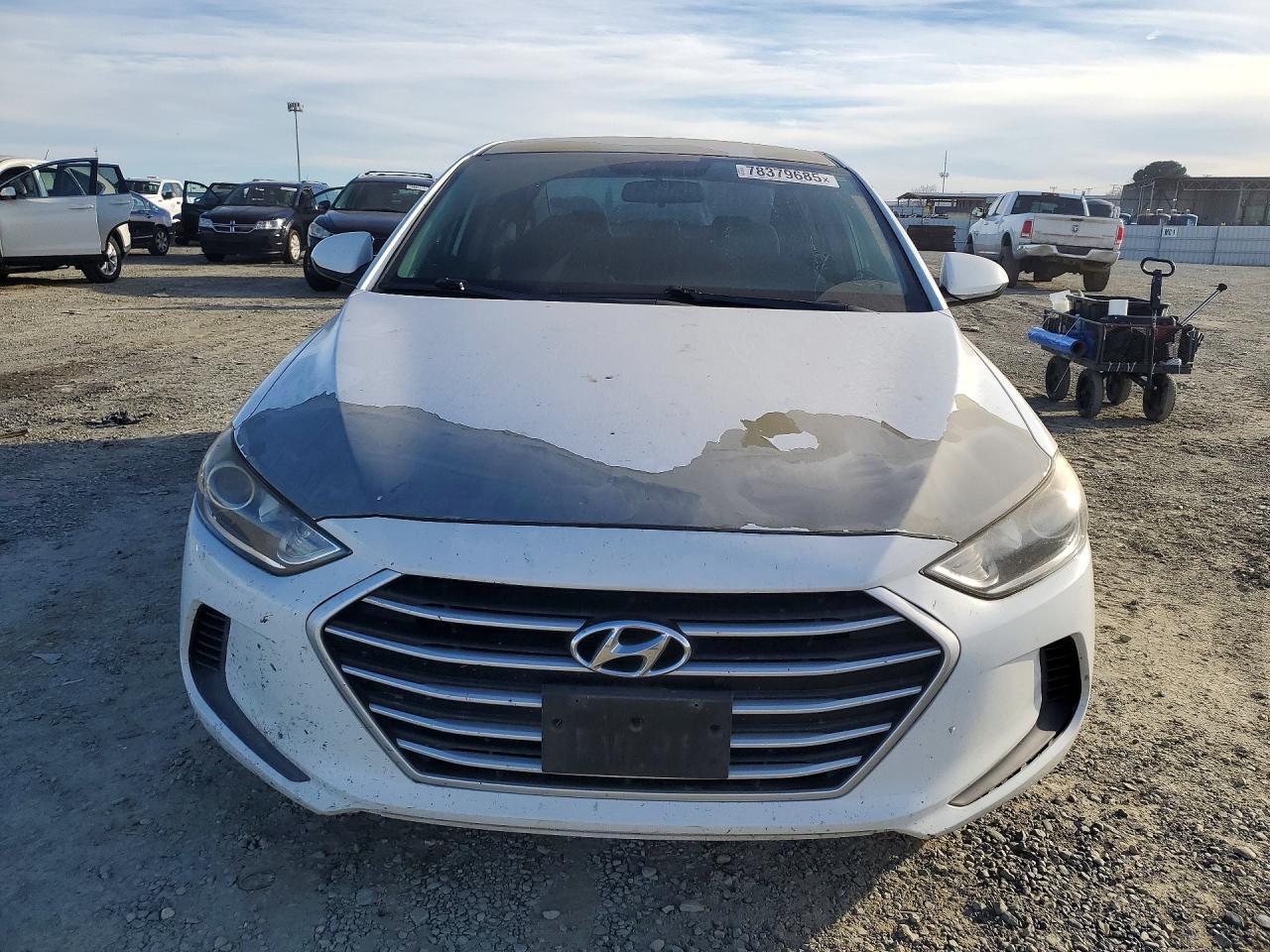 2017 HYUNDAI ELANTRA