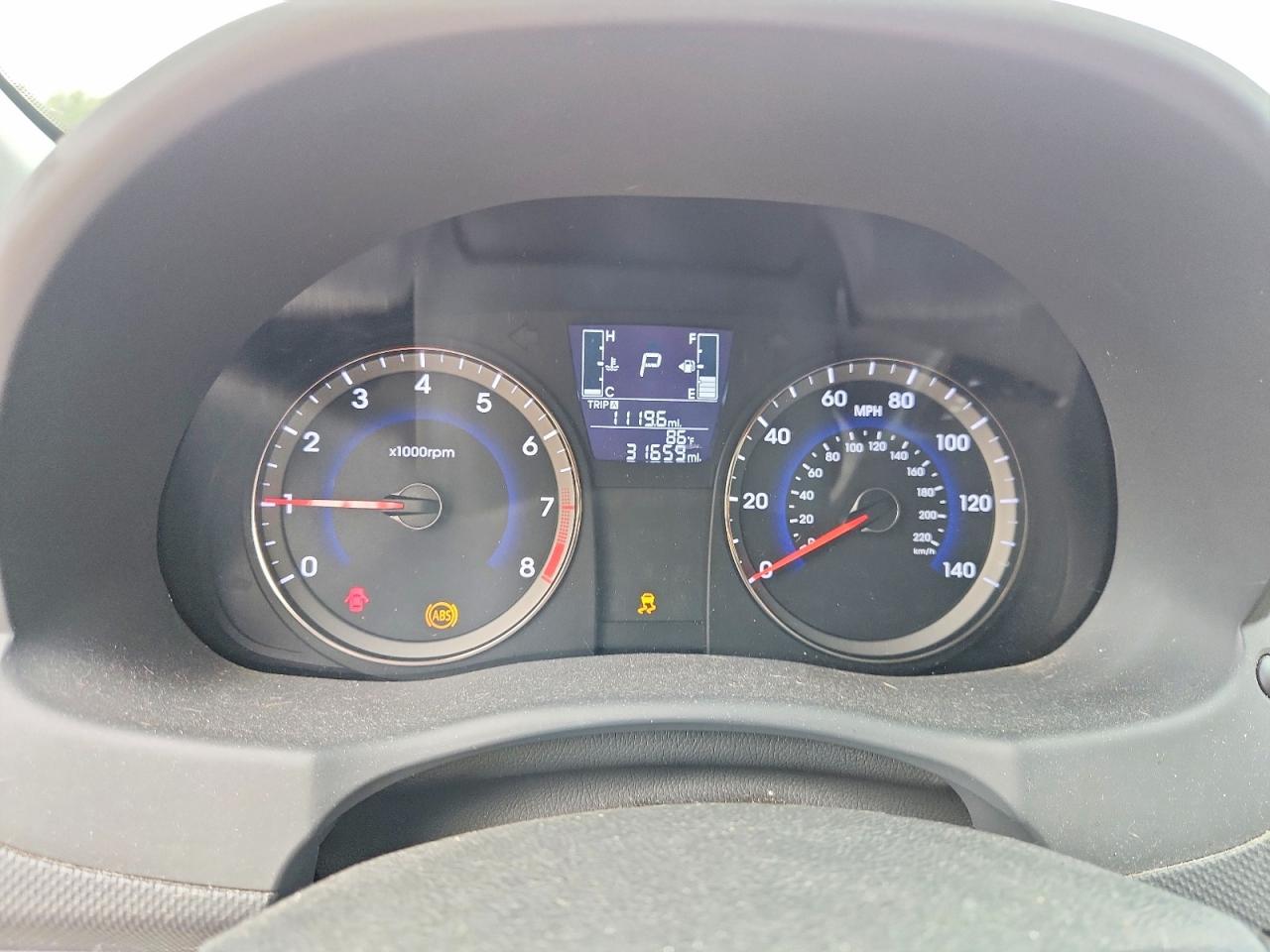2017 HYUNDAI ACCENT