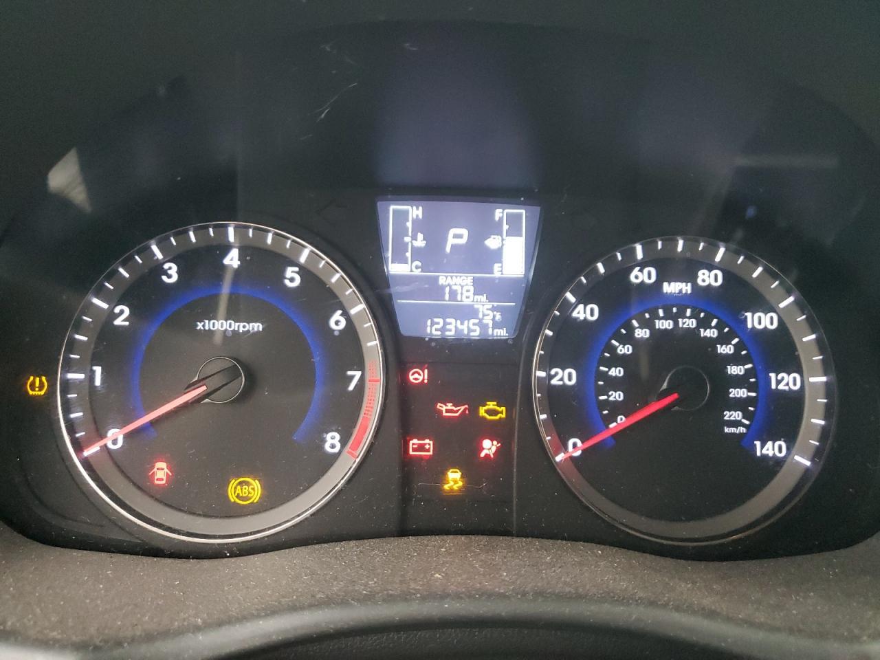 2016 HYUNDAI ACCENT