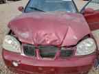 2004 SUZUKI Forenza