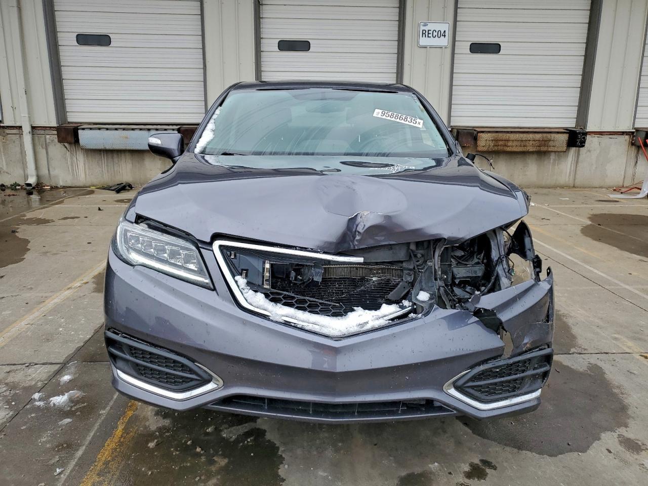 2017 ACURA RDX